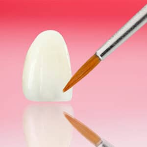 Fluoride Treatment in dental hygiene- Tacoma WA Dentist