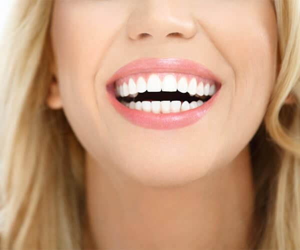 White teeth of a woman after comprehensive hygiene by Tacoma dentist at Soundview Dental Arts